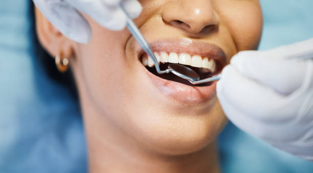 Best Emergency Tooth Extraction in Effingham, IL