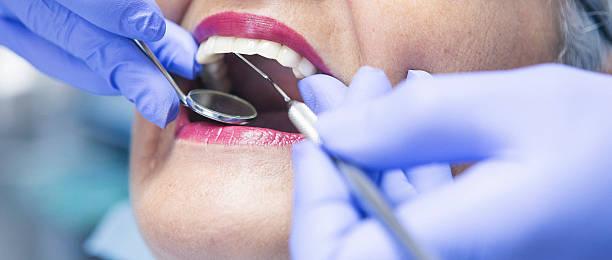 Best Emergency Tooth Extraction in Effingham, IL